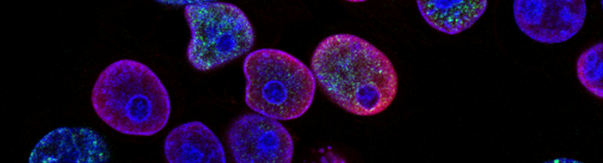 Immune effector cell therapies to combat cancer
